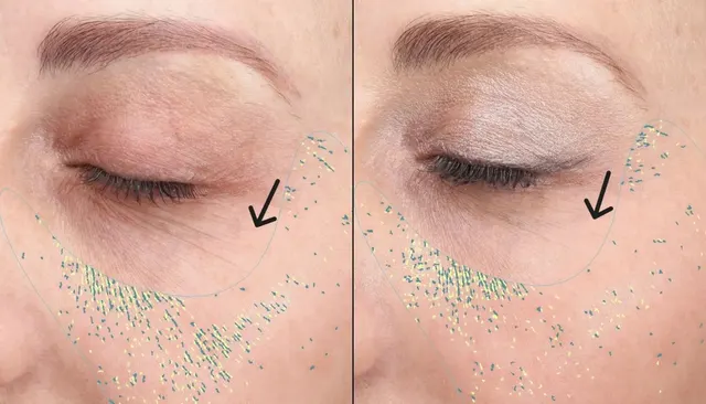 Cool Peel before and after