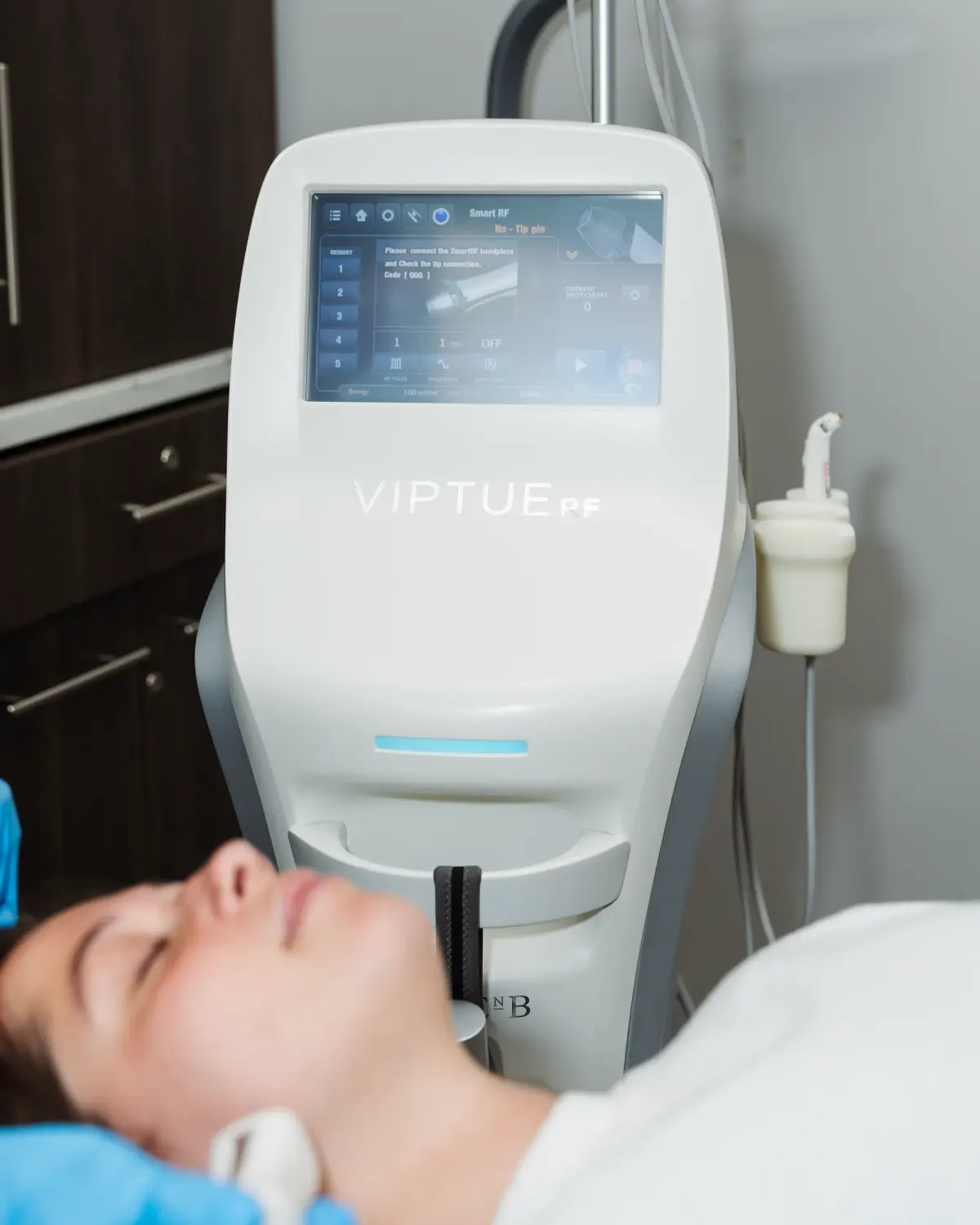 Before and after exosome therapy transformation at Pura Vida Med Spa in Fulton, MD