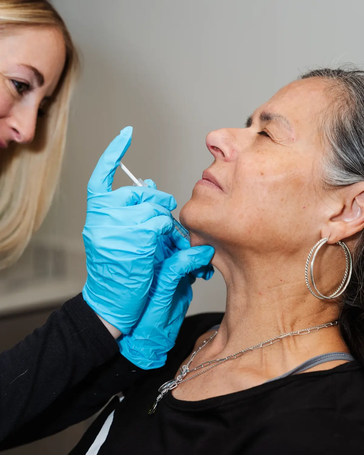 Gloved injector marking a mature client's face before a filler treatment