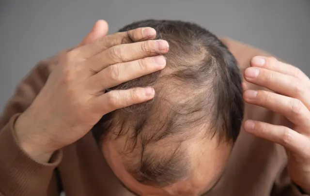 Patient receiving HydraScalp Keravive treatment at Pura Vida Med Spa in Fulton, MD
