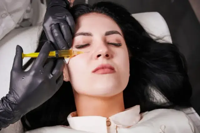 Derma PRP vs. Fillers Under Eyes: How It Works, Benefits, and Cost