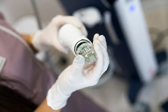RF Microneedling vs. Traditional Microneedling: Which Delivers Better Results?