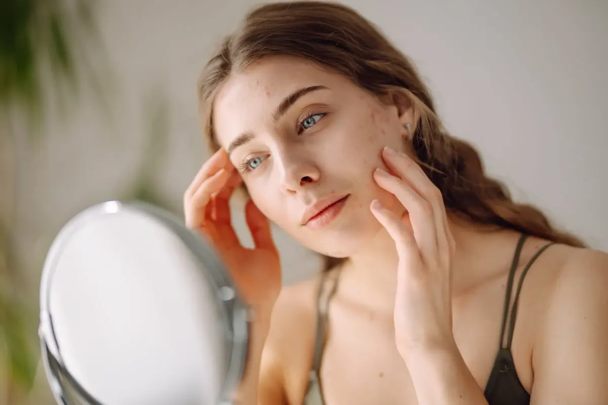 Patient examining acne scarring in mirror at Pura Vida Med Spa in Fulton, MD