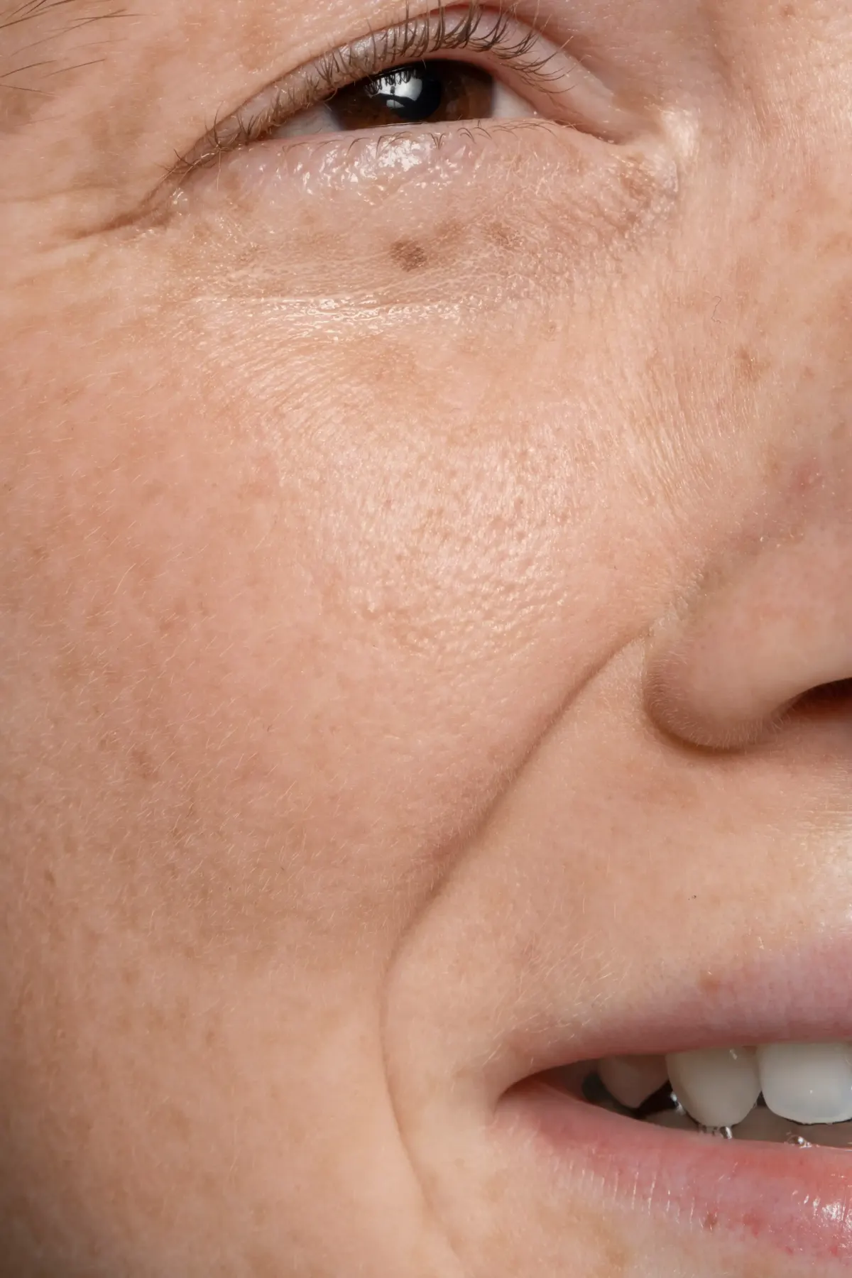 Extreme close-up of cheek showing enlarged pores and skin texture