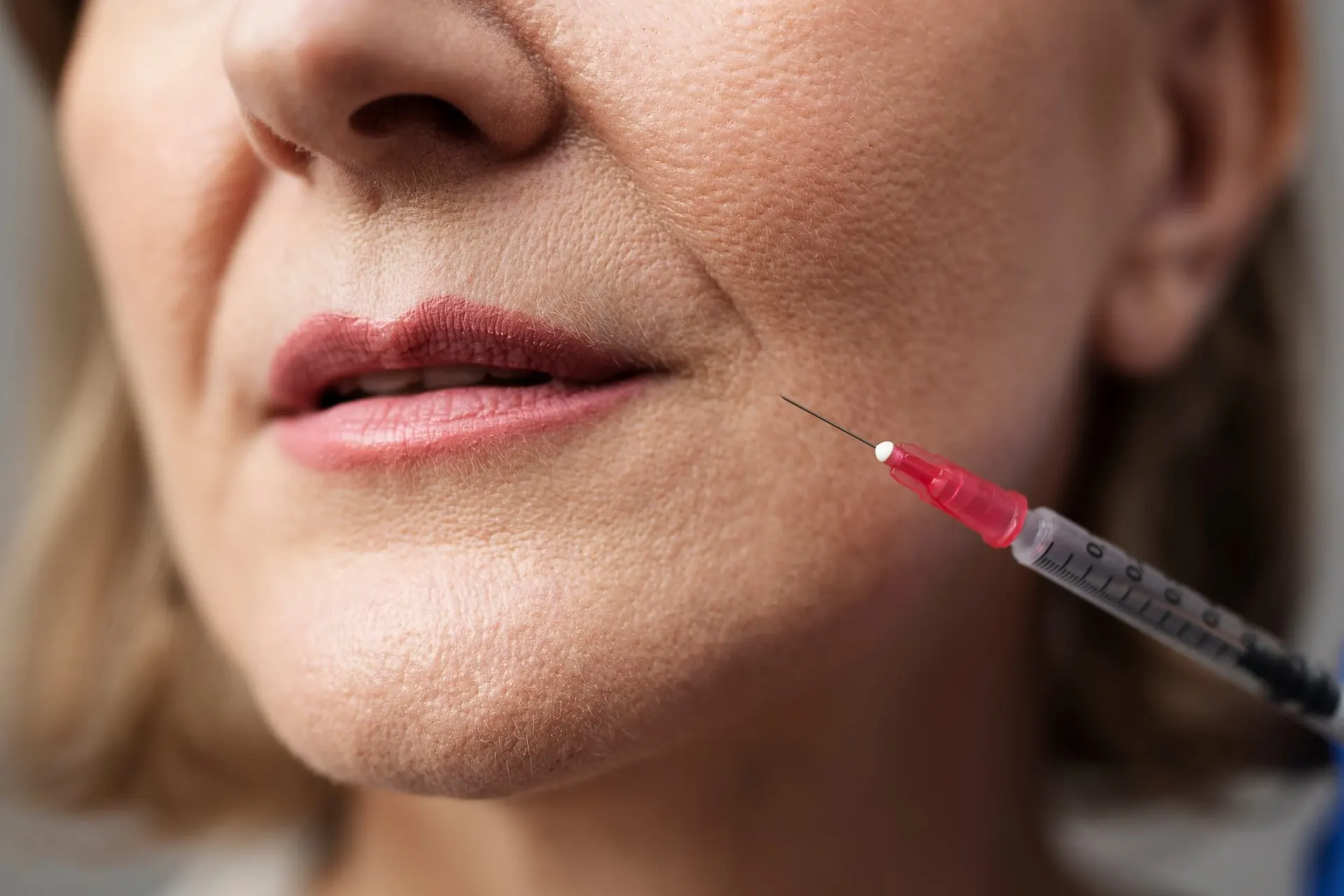 Patient receiving RHA Filler treatment at Pura Vida Med Spa in Fulton, MD