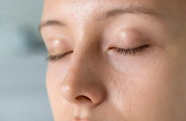 Close-up of a woman's nose and cheeks showing oily skin and pores