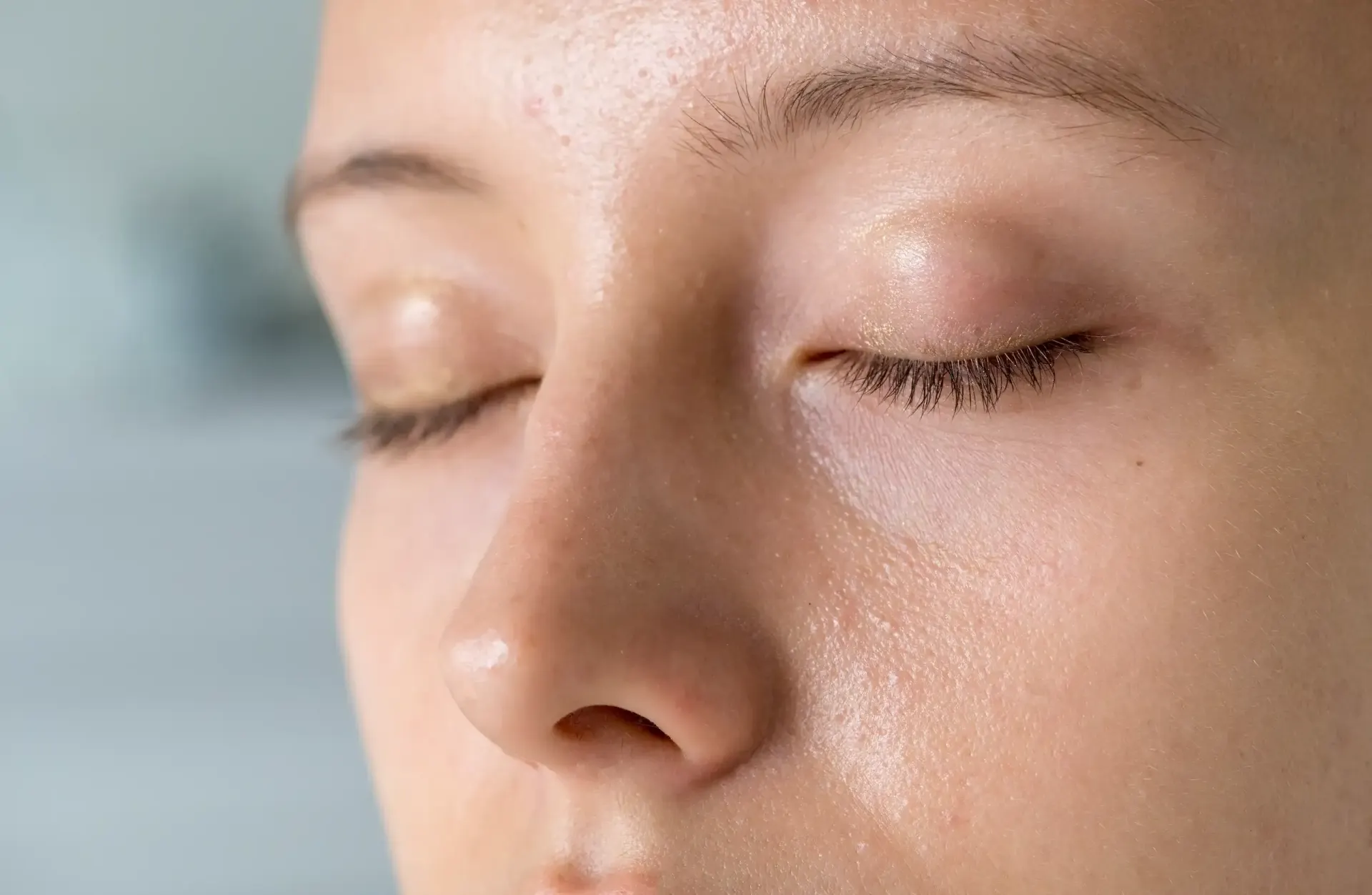 Close-up of a woman's nose and cheeks showing oily skin and pores