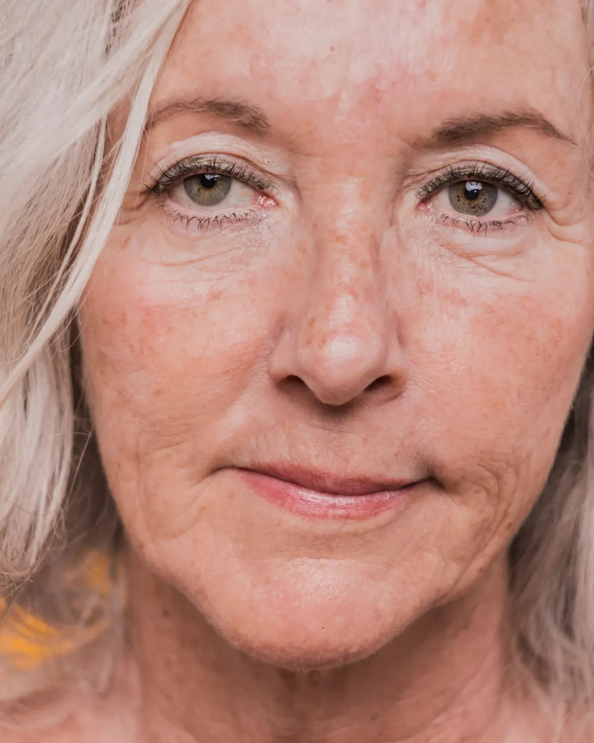 Close-up of older woman's face with uneven pigmentation and fine wrinkles