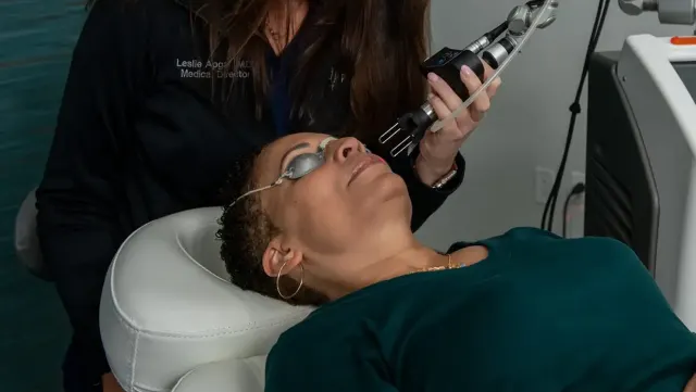 Dr. Leslie Apgar MD performing a CoolPeel CO2 laser resurfacing and skin tightening treatment on a patient at Pura Vida Med Spa in Fulton Maryland