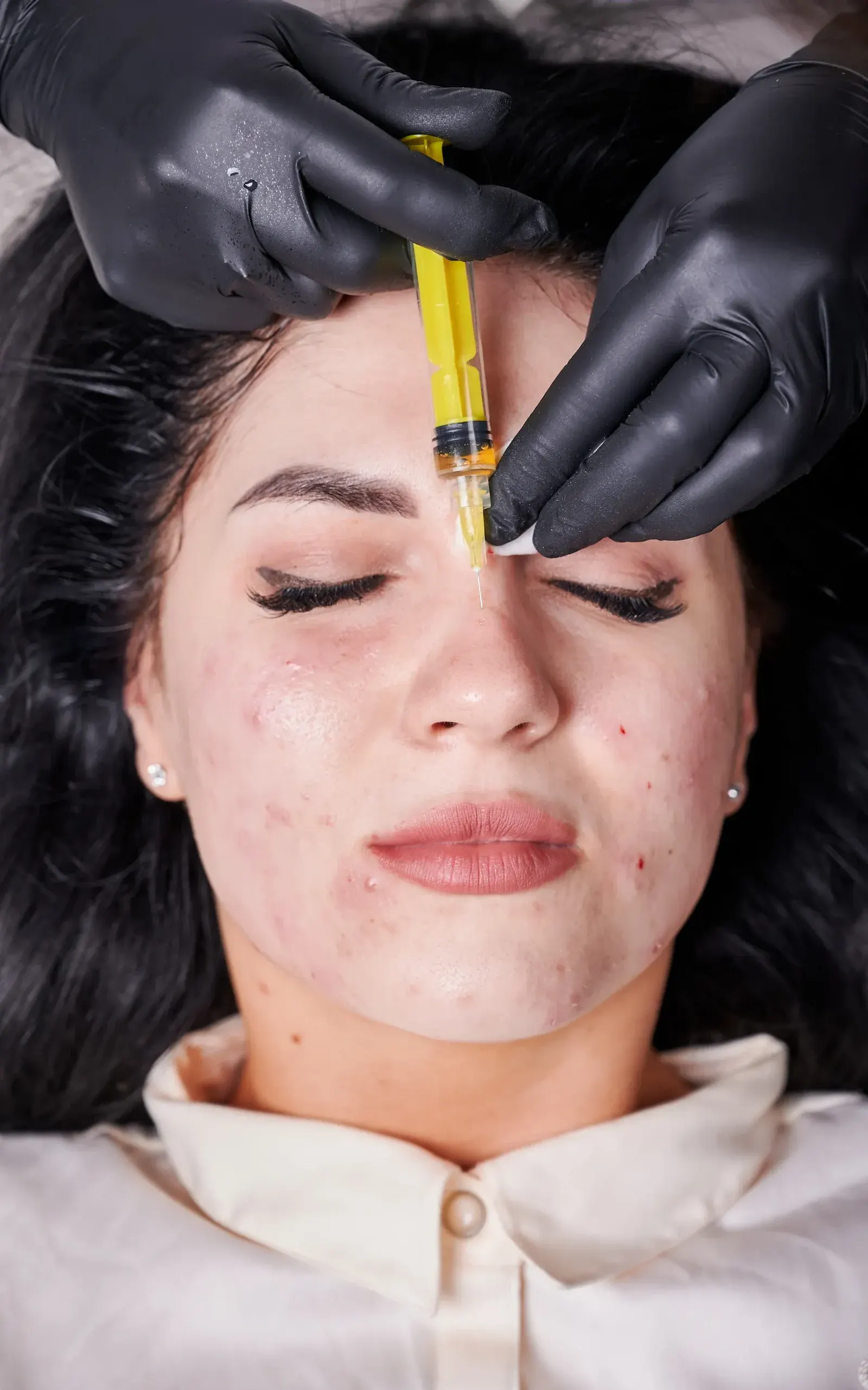 Clinical-grade safety setup for PRP facial treatment at Pura Vida