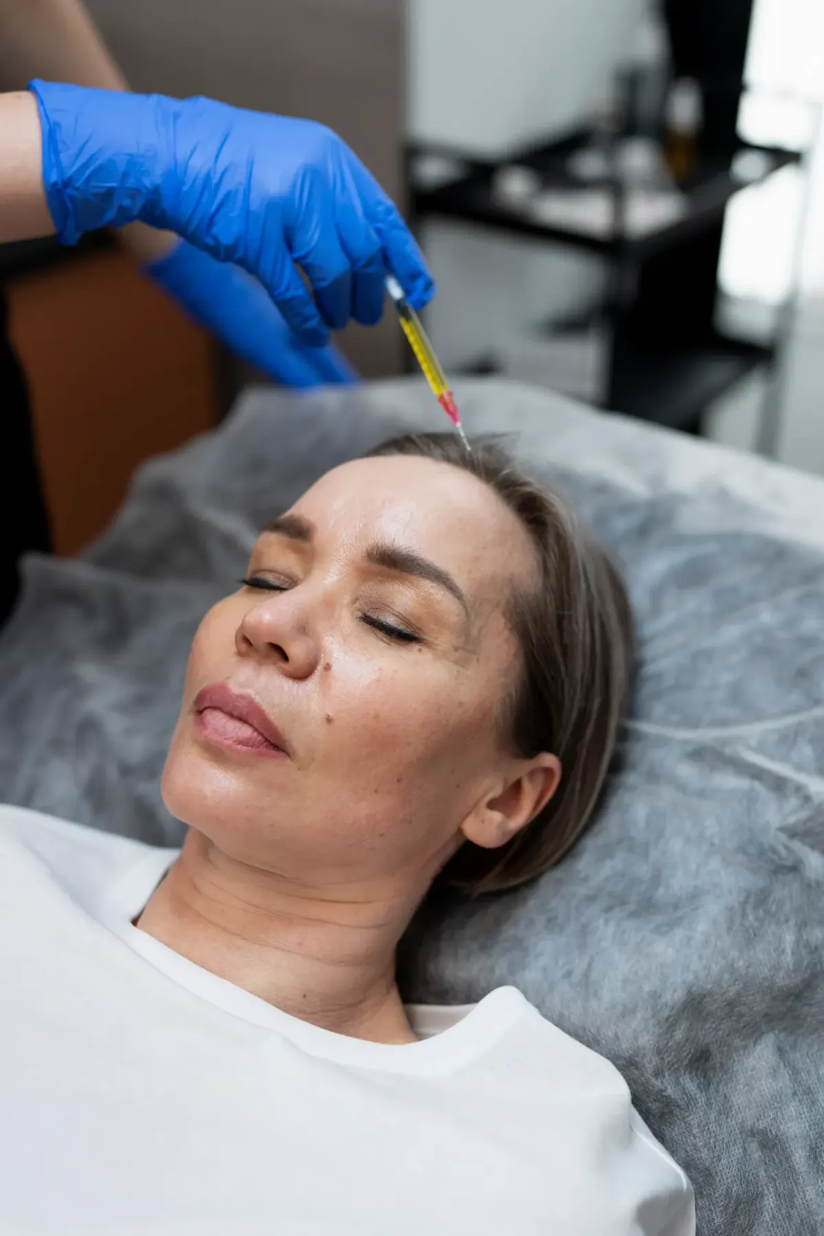 Before and after results of PRP hair treatment showing improved hair density at Pura Vida Med Spa