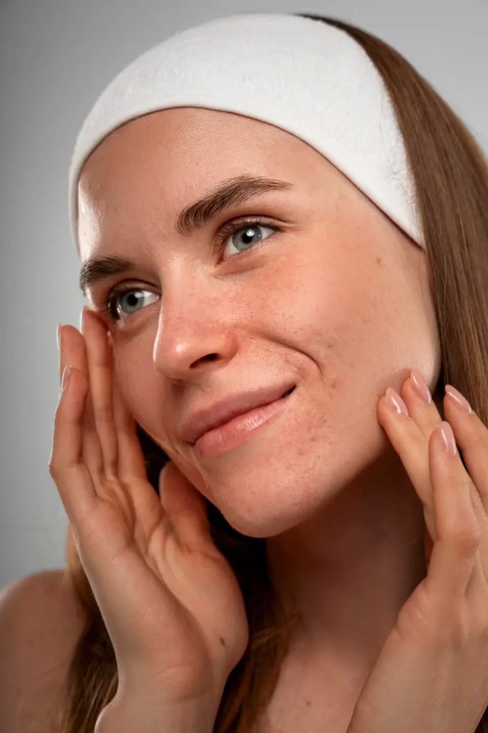 Woman in white headband touching her face with visible skin blemishes