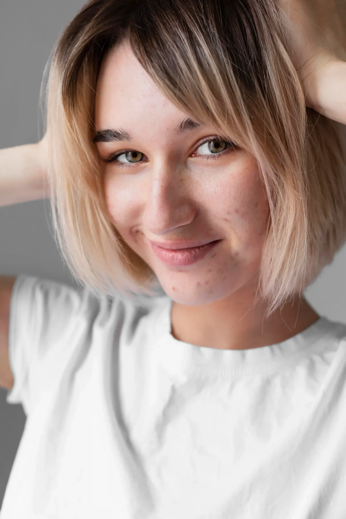 Smiling young woman with short blonde hair and light acne on cheeks