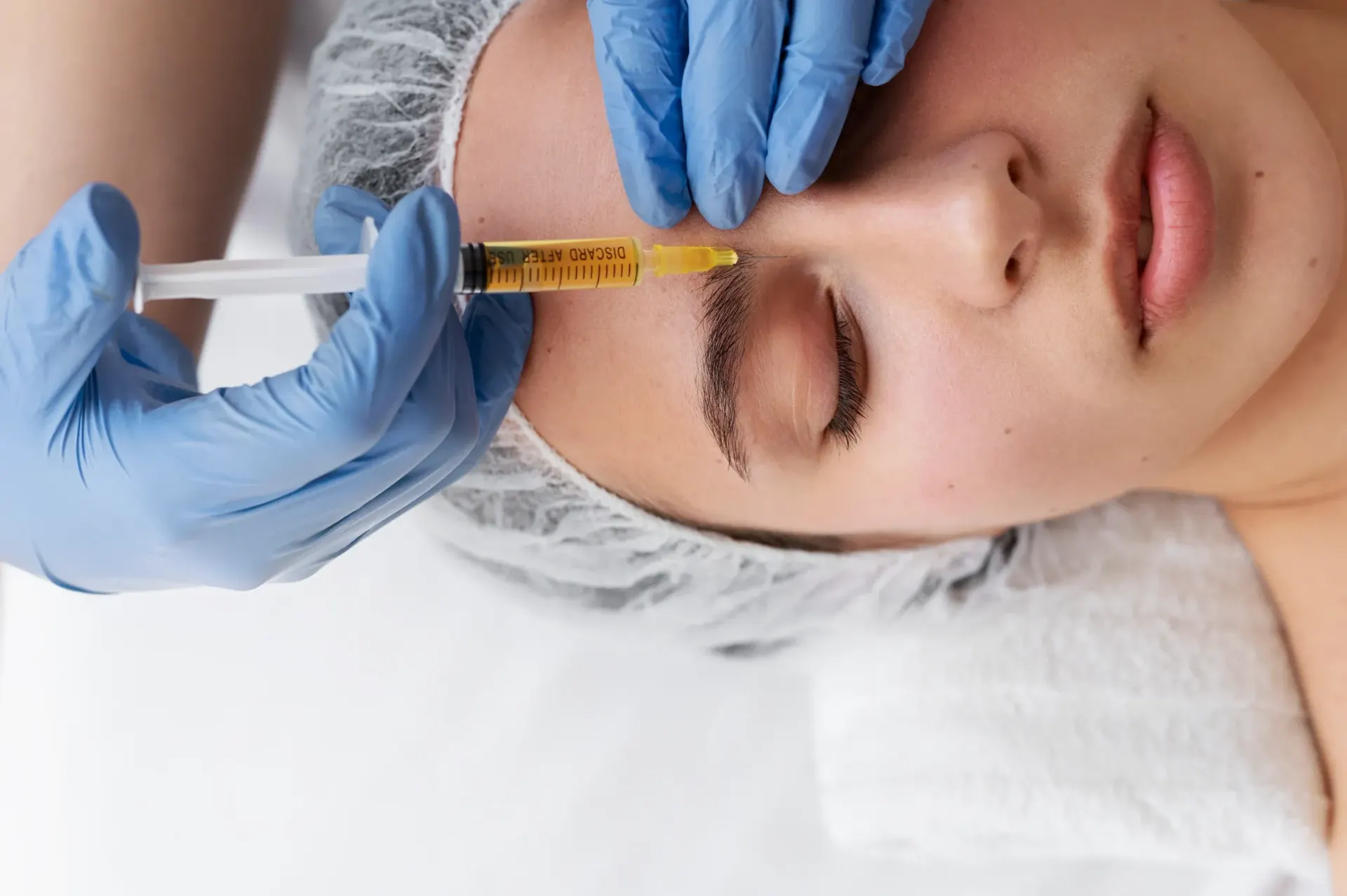 Patient receiving a PRP facial treatment at Pura Vida Med Spa in Fulton, MD