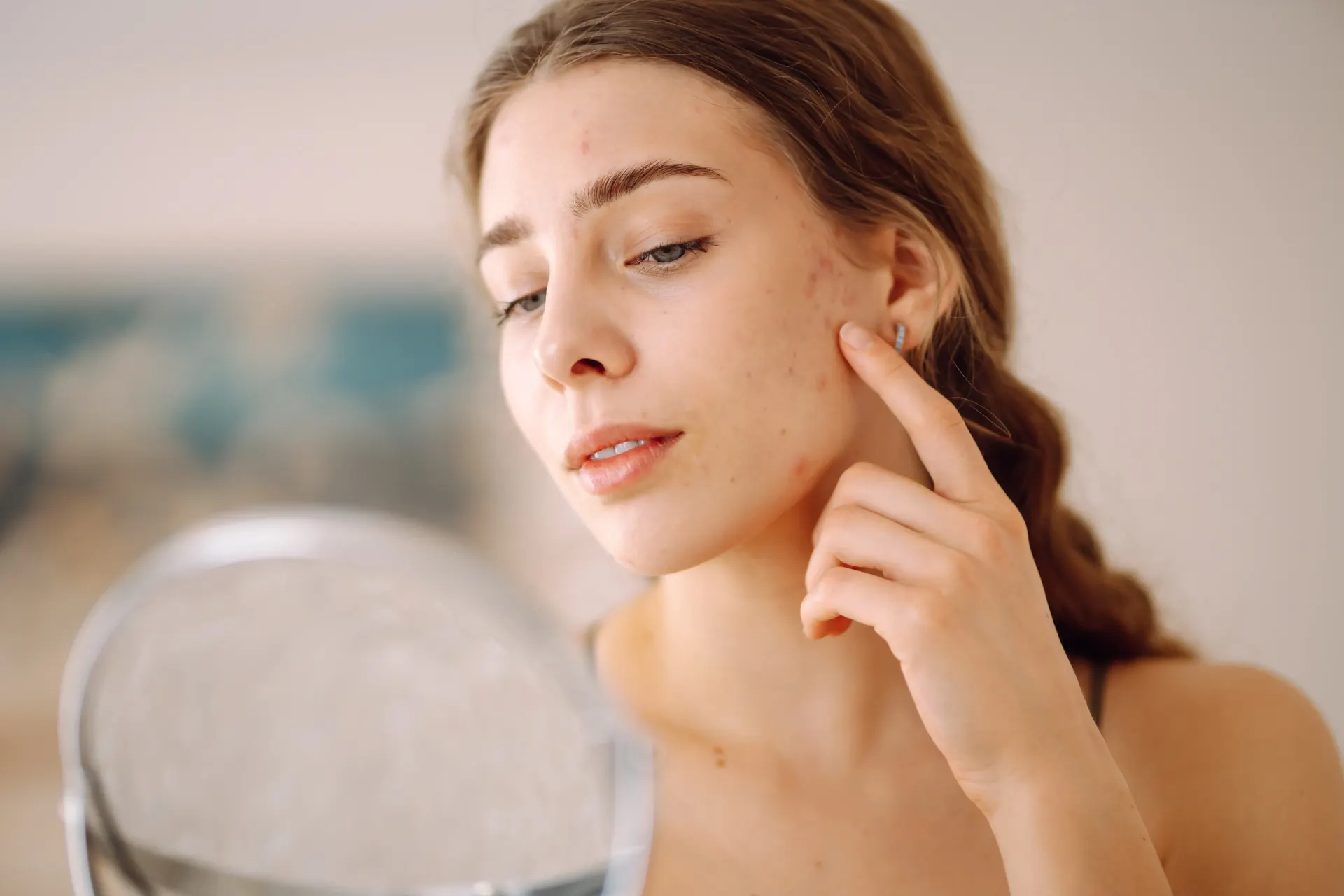 Young woman examining acne blemishes on her cheek while holding a mirror